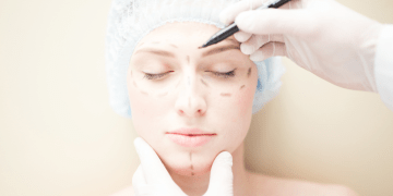 Mery Lamah, Dra. experta en amonización facial, revela las claves para corregir con éxito esa parte del rostro que nos preocupa