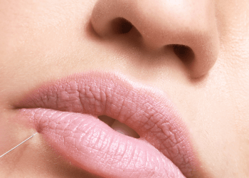 Dr. Rodrigo Martínez: «El tratamiento de mayor tendencia ahora mismo es la redensificación»