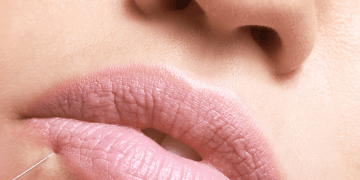 Dr. Rodrigo Martínez: «El tratamiento de mayor tendencia ahora mismo es la redensificación»