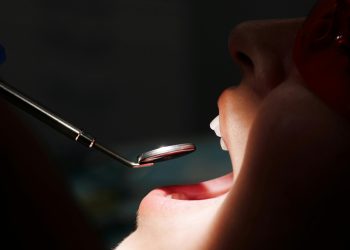 Clínica Dental Myca: mitos y verdades sobre el blanqueamiento