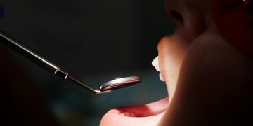 Clínica Dental Myca: mitos y verdades sobre el blanqueamiento