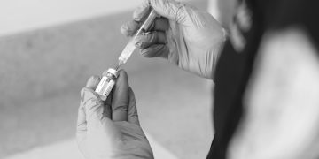 Botox y rellenos dérmicos: La revolución del rejuvenecimiento facial no invasivo